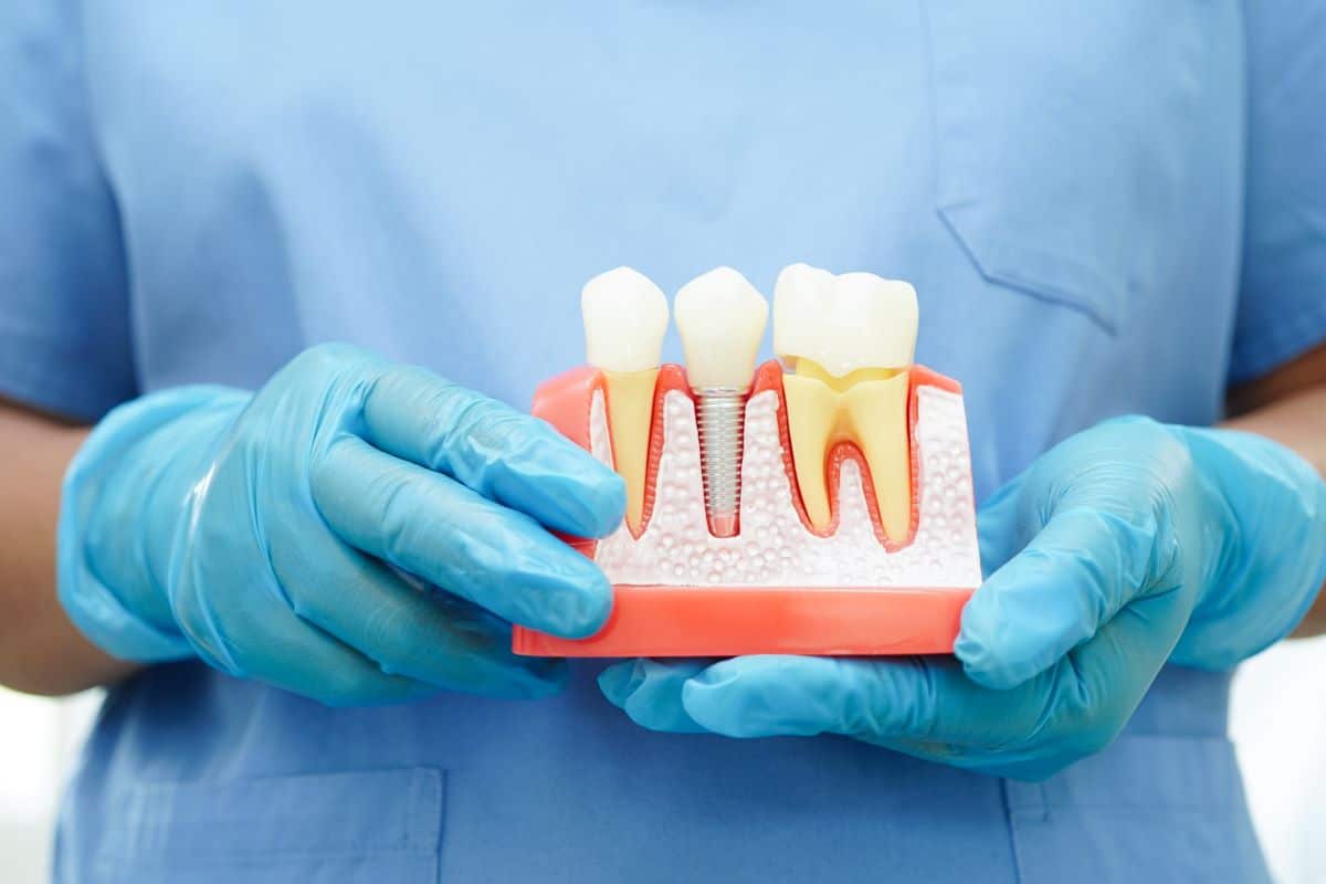 Dental implant consultation in Fair Oaks, California